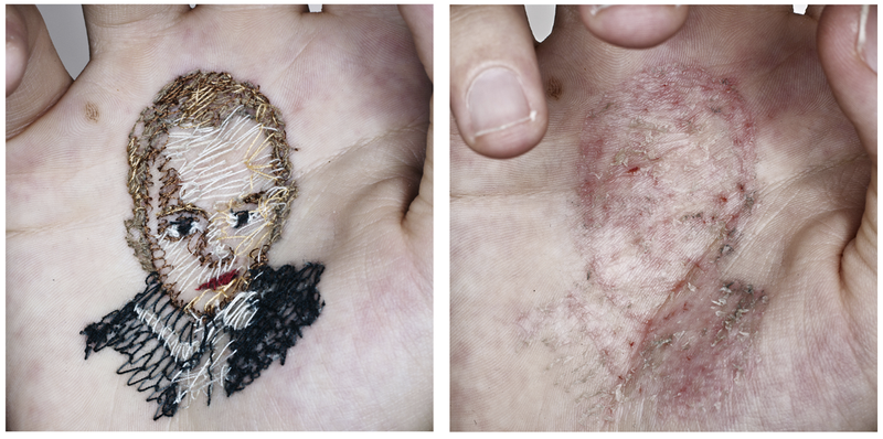 Illustration for article titled Artist embroiders portraits into his own flesh—and then tears them out